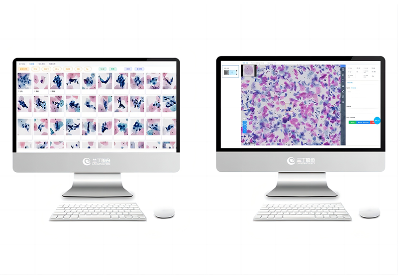 Introduction to AI-Assisted Cervical Cytology Examination System