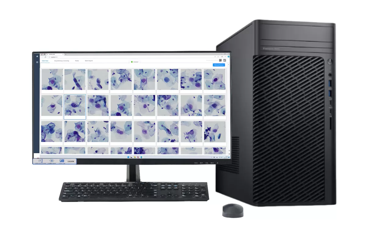 On-premise AI Cervical Cytology Solution